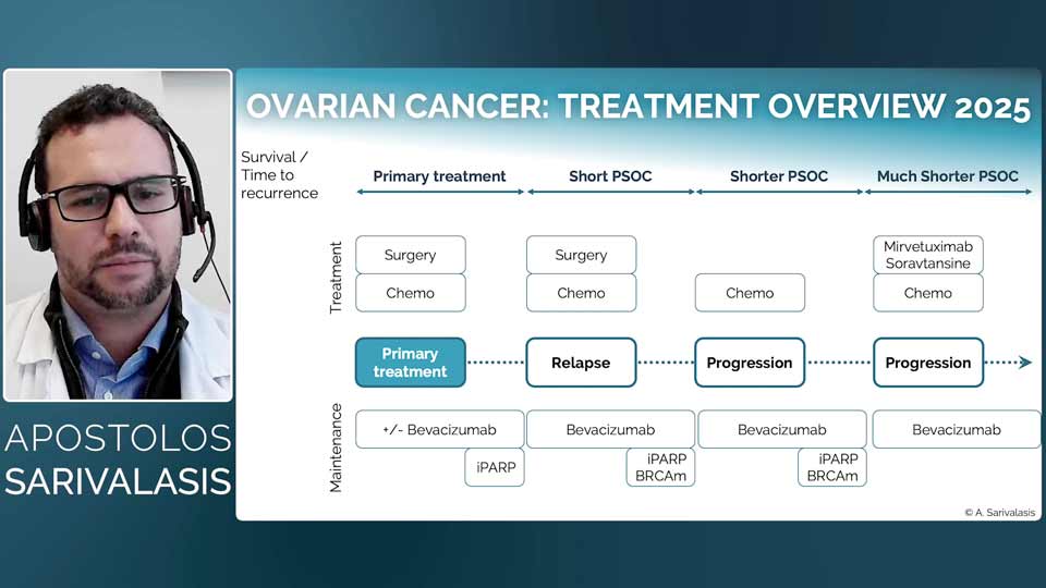 Ovarian Cancer by Apostolos Sarivalasis